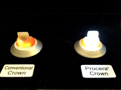 メタルボンド　セラミック　ジルコニア