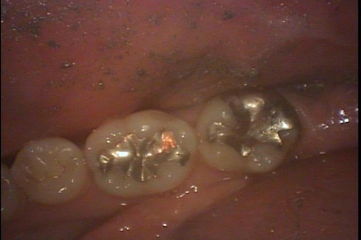 o0720048014780367306