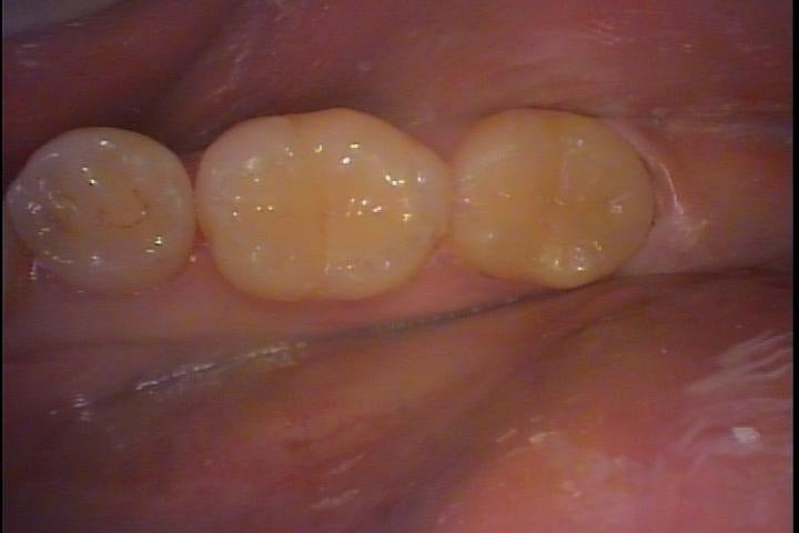 o0720048014780367314