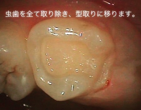 o0480037414780367318
