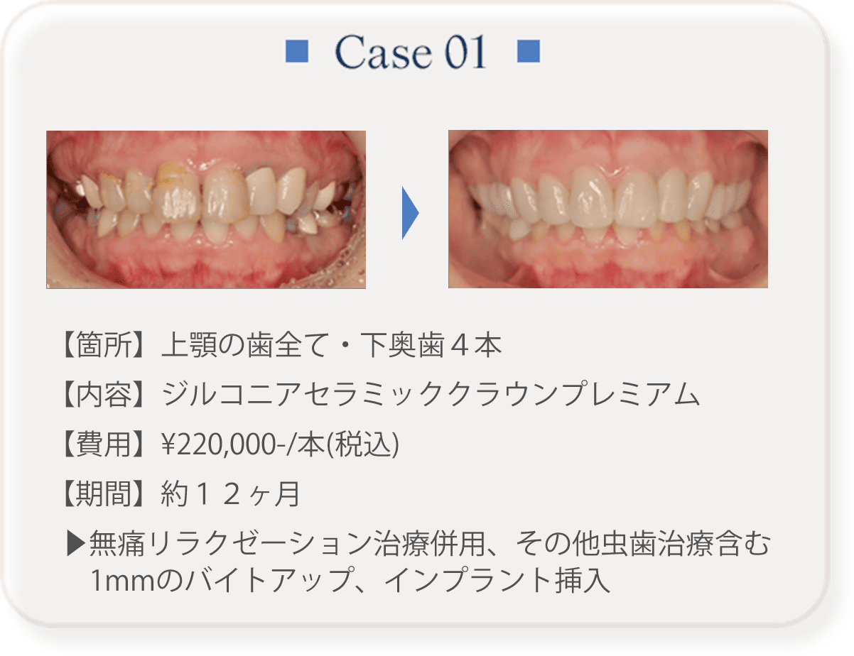 Case 01