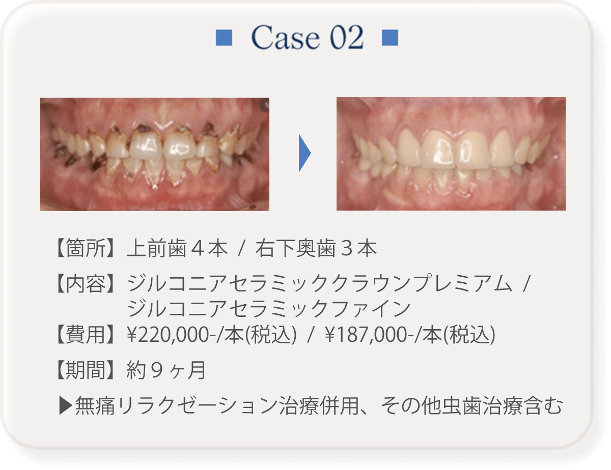 Case 02