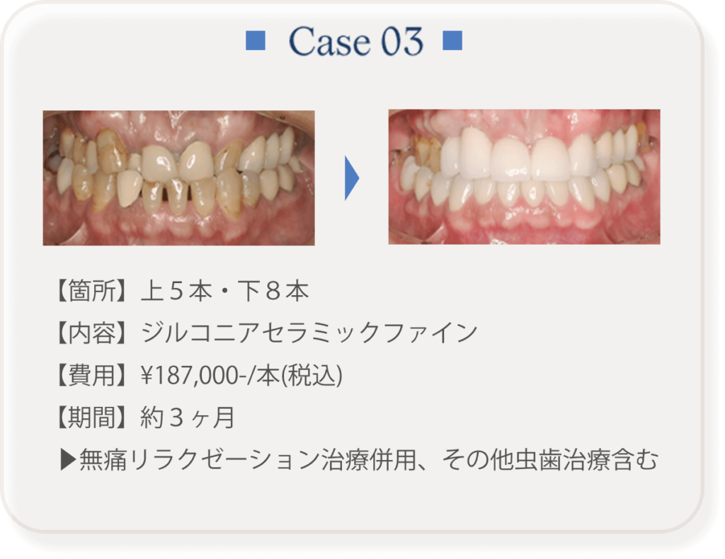 ケース３