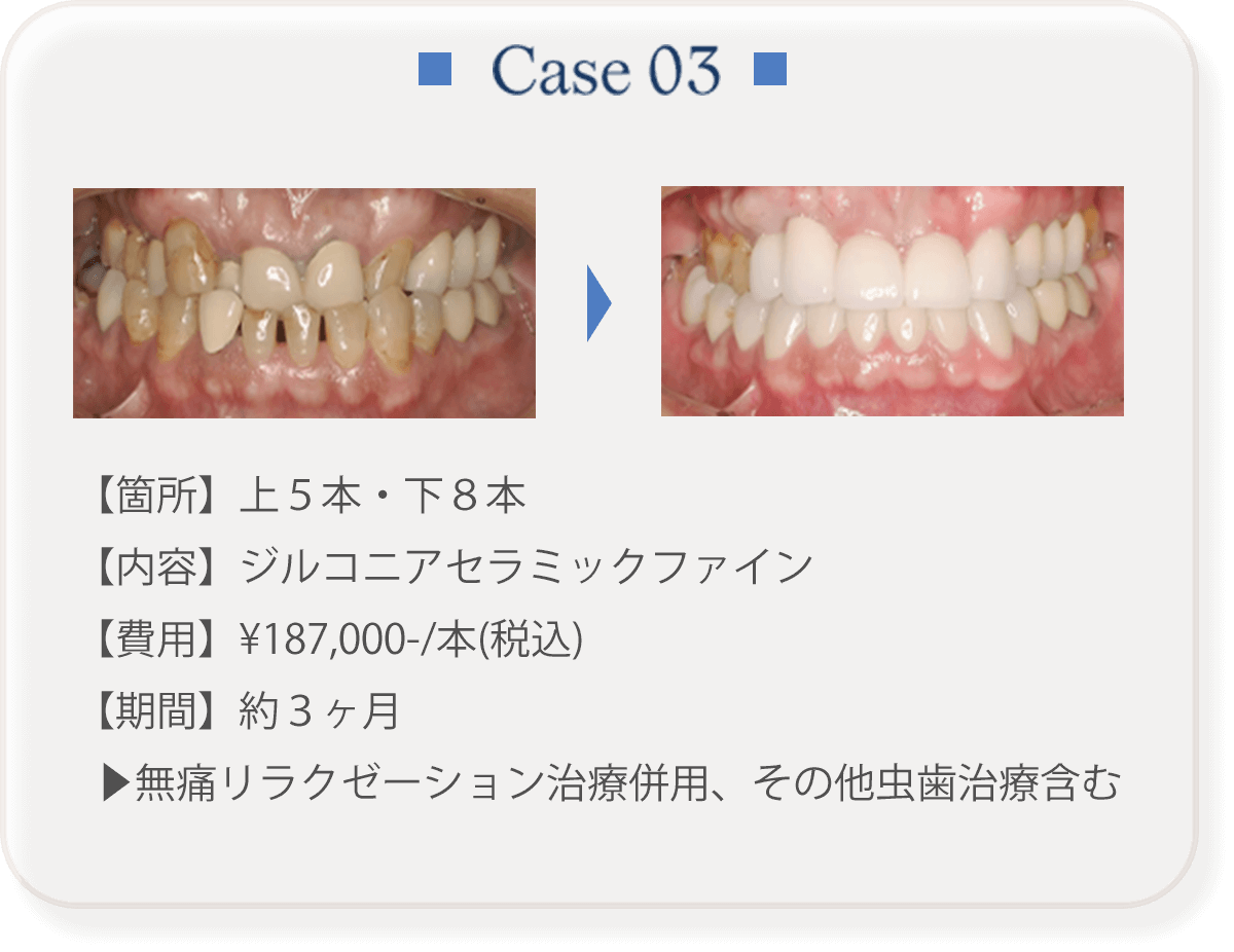 Case 03