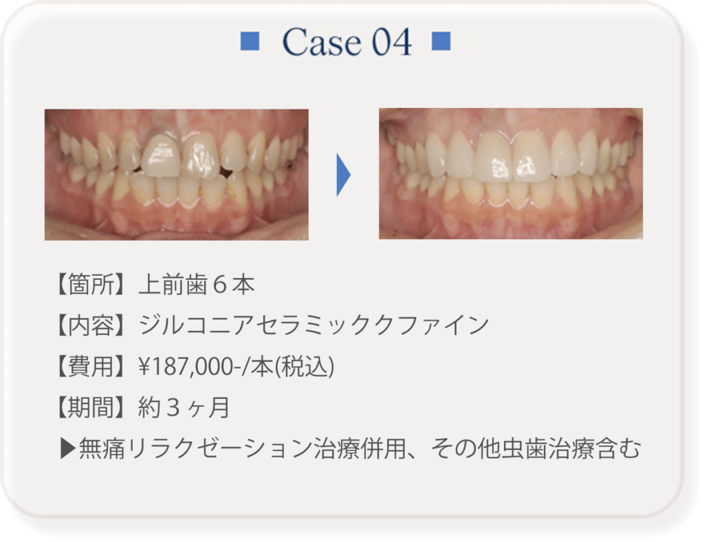 ケース４