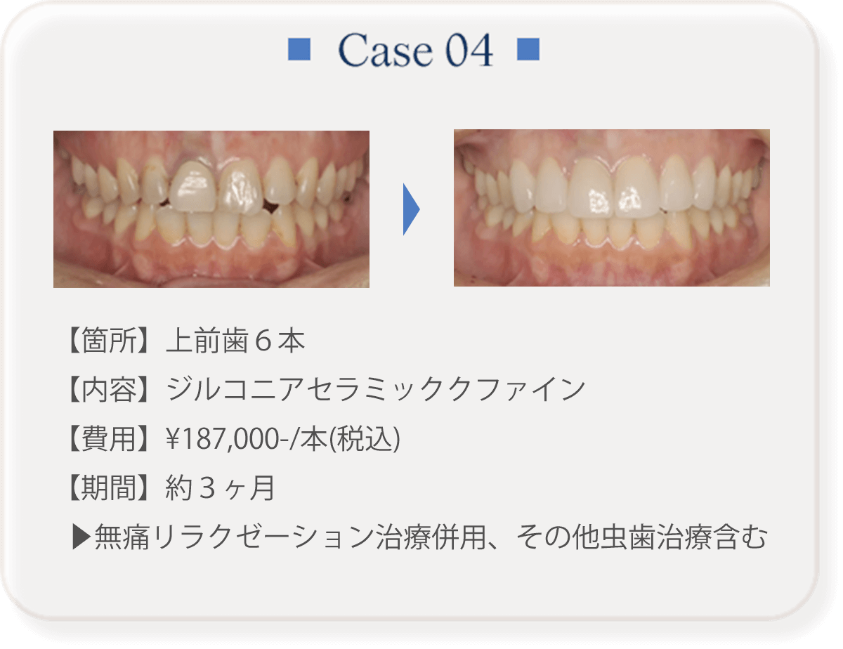 Case 04